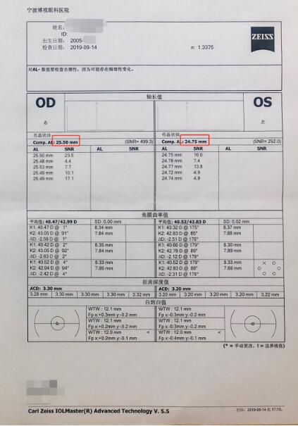 眼轴长度:右眼25.55mm,左眼24.73mm2021年1月眼轴长度:右眼25.