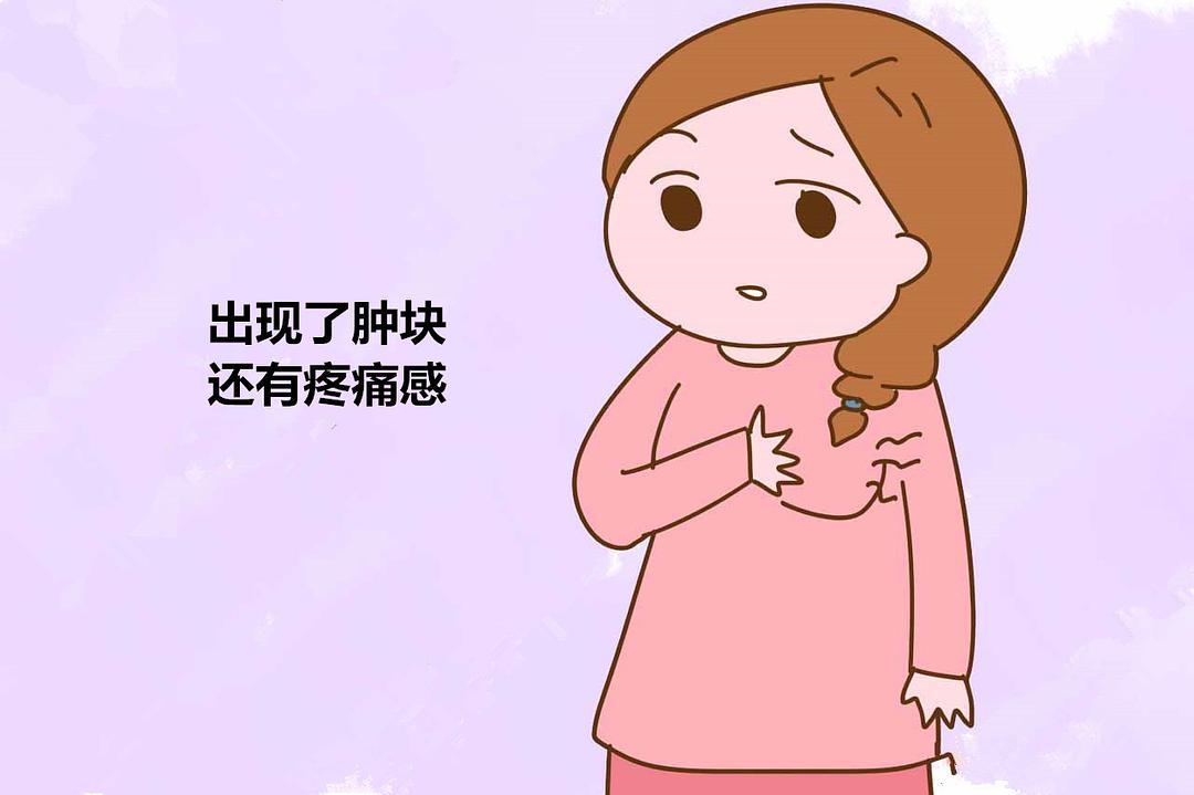 广州中医药大学金沙洲医院著名肿瘤专家潘静教授乳腺增生有哪些症状