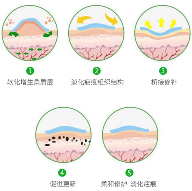 被痘疤痘印所困扰试试mavm祛疤膏