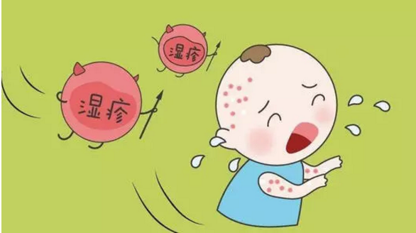 婴儿湿疹是什么原因引起的 宝爸宝妈赶紧排查这些原因