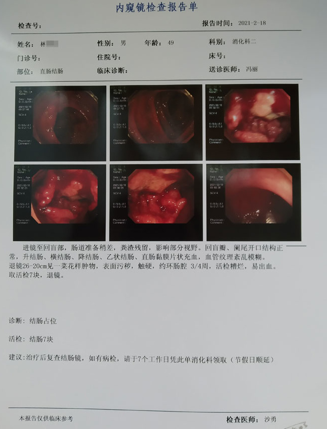 佛山肛泰胃肠医院专家冯丽主任揭秘:为什么很多肠癌一