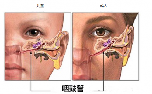 老病新治—中耳顽疾金疗法·咽鼓管球囊扩张术