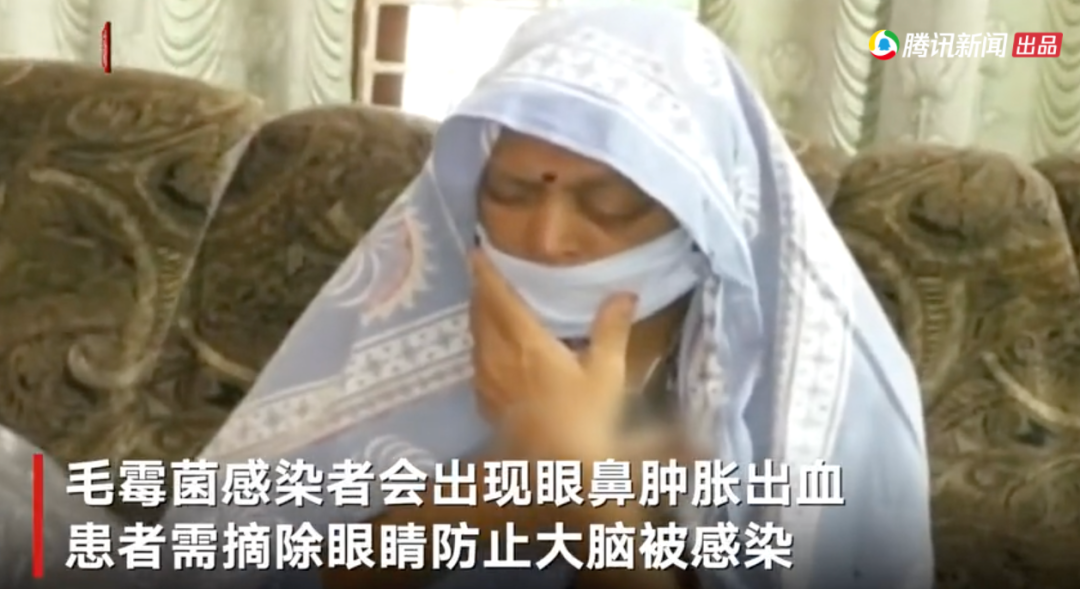如今毛霉菌病确诊人数激增,上百人死亡! 毛霉菌病死亡率