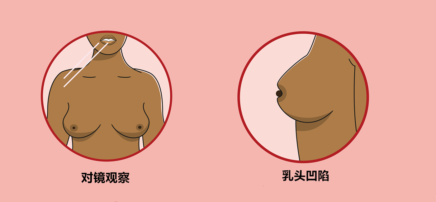 听说全球发病率最高的乳腺癌有办法预防?