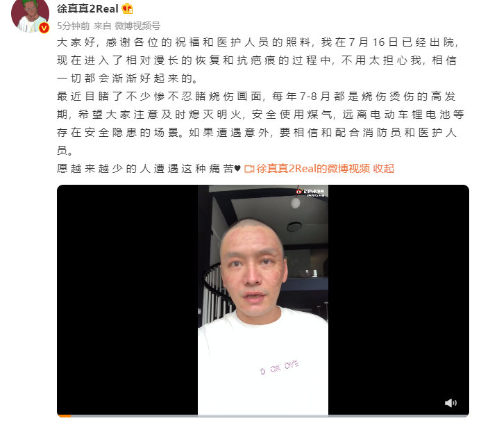 说唱歌手徐真真出院报平安 烧伤疤痕十分明显