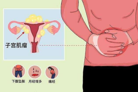 女性的生殖系统主要分布在腹部,如腹部出现疼痛,则很有可能是妇科疾病