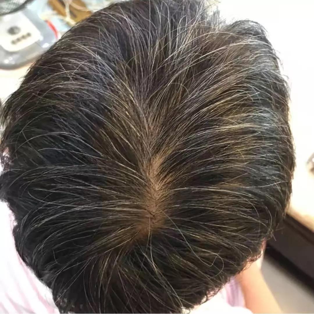 德国93岁老太头发浓密乌黑只因每天用它洗头