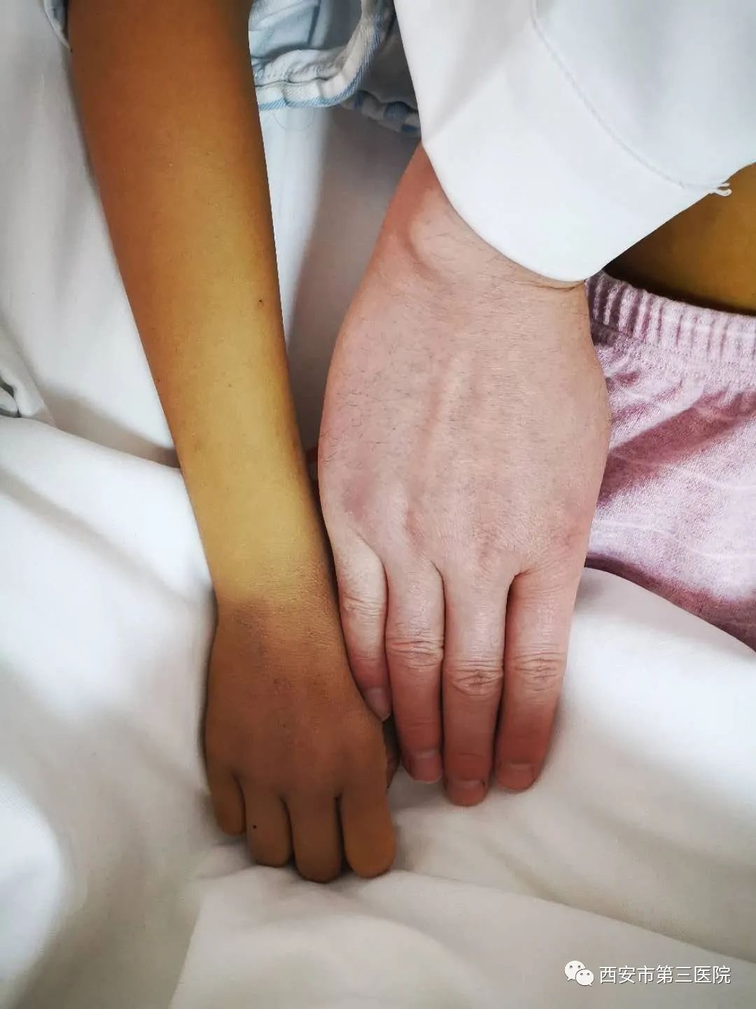 救"8岁女孩"生命于危难该患儿1月前出现腹痛,3周前出现全身皮肤巩膜黄