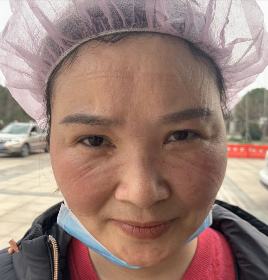 肖护士照片与护士的交谈中,我又得知,同行的肖护士,第一天脸就被勒得