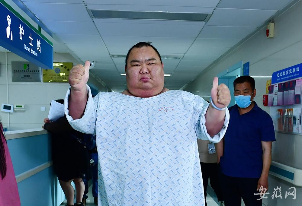 安徽450斤超级胖友接受减肥手术胃被切除三分之二