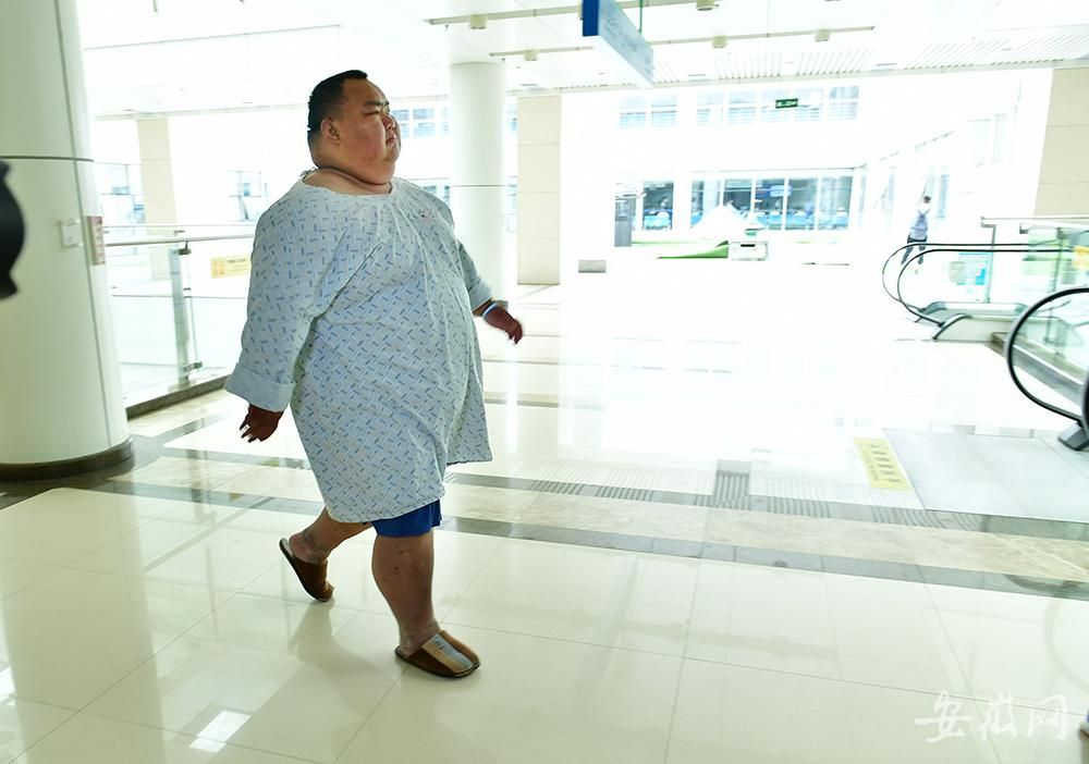 安徽450斤超级胖友接受减肥手术胃被切除三分之二