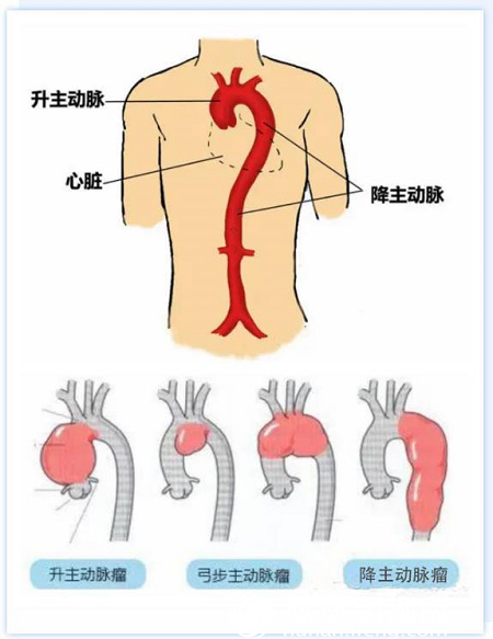 胸主动脉位置图片图片