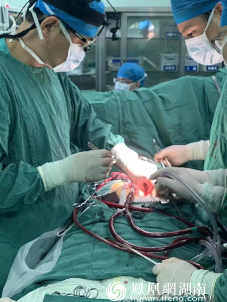 常德一医心血管外科医生实施体外循环手术
