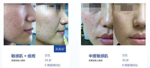 皮肤修复屏障三个月后的表现 eaa44497f0a1ac4_w500_h228.png