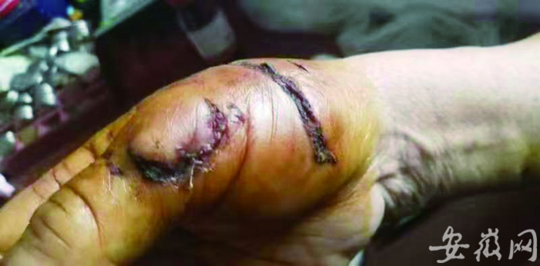 12 月14 日,在阜阳市临泉县瓦店镇,一条身长约1 米的藏獒,突然兽性