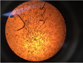 显微镜下的根结线虫