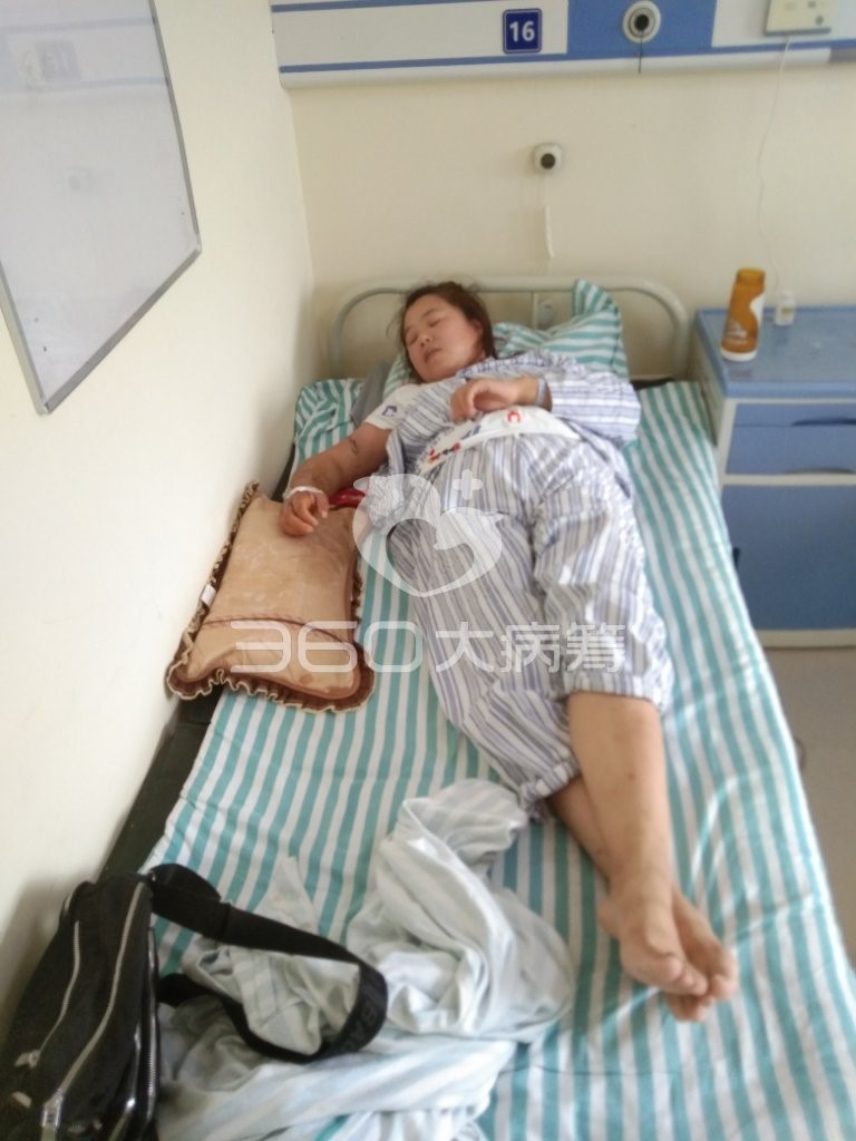 80后夫妻面对不幸不离不弃 求助360大病筹只为保住妻子手臂