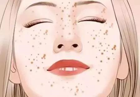 祛斑小妙招如何祛斑淡斑
