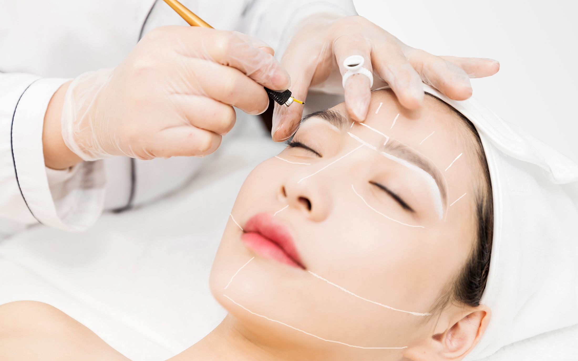 线雕和超声刀同时做会发生什么