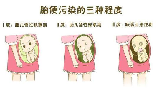 是什么让胎宝的生命水变脏了