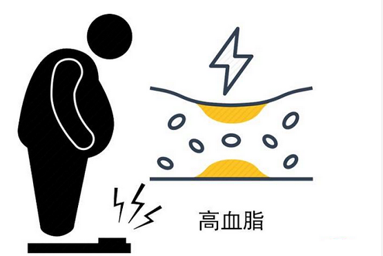 吃素就能远离高血脂？医生告诫：关于高血脂的5个说法，切勿听信__凤凰网