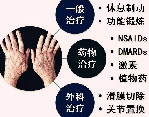 类风湿关节炎的治疗原则