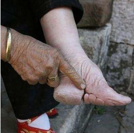 世界畸形审美三强中国裹脚欧洲束腰日本不伤人但很无语