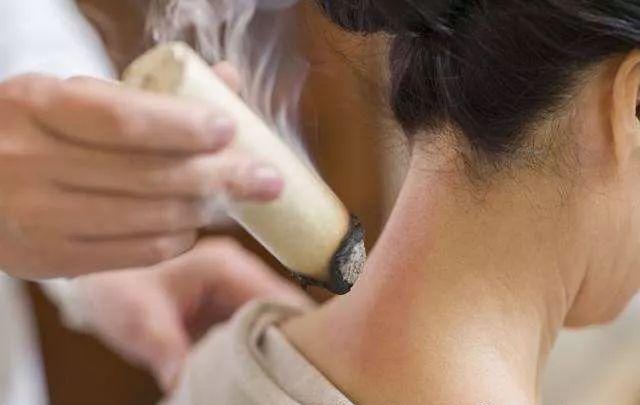 艾灸大椎通七经调阳气是身体上的小太阳