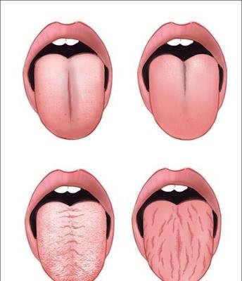 舌头有横纹图片