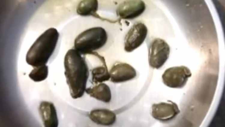 吃鱼胆能清热解毒?7岁女童误食进了重症监护室_凤凰网视频_凤凰网
