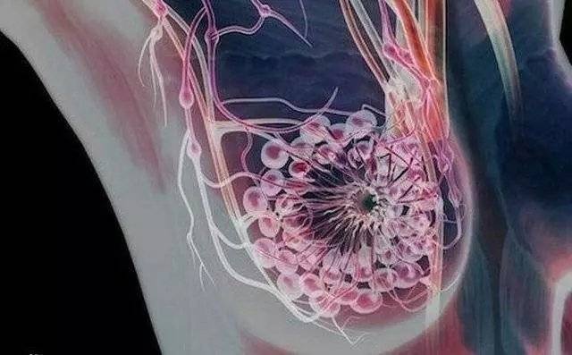 乳腺导管扩张什么意思图片