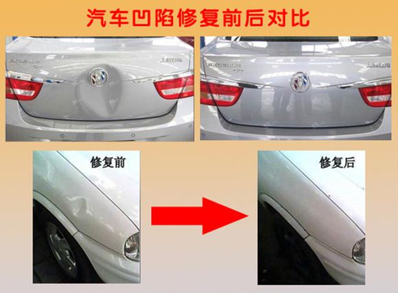 「」行业的革新：从凹陷修复到全面焕新