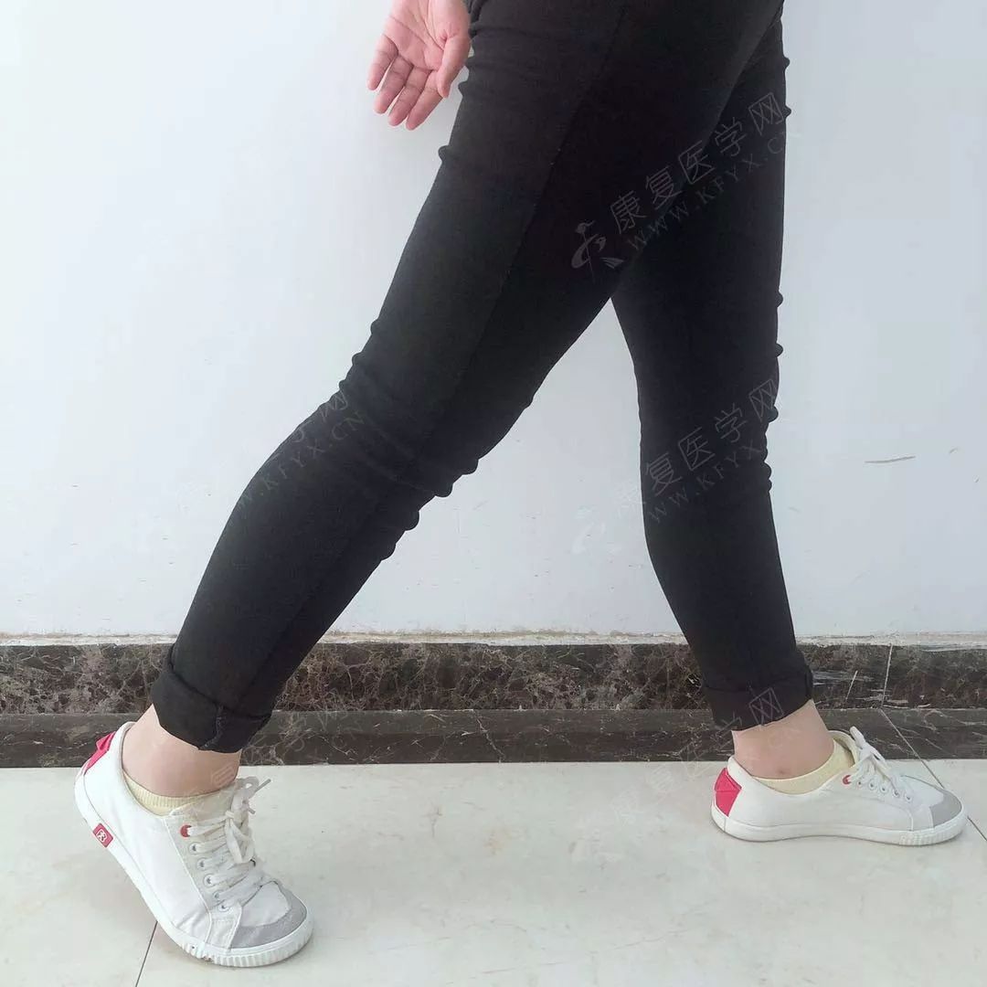 两腿长短不齐是常见的结构异常之一.