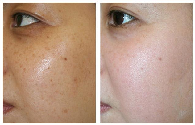 皮肤暗黄暗沉身体该如何调理