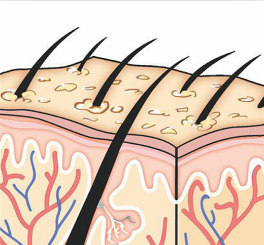 脱发不生长毛囊不生发怎么办你的生发环境具备吗