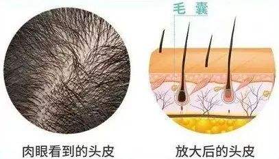 毛囊会像头发一样脱落吗毛囊坏死了还能再生吗