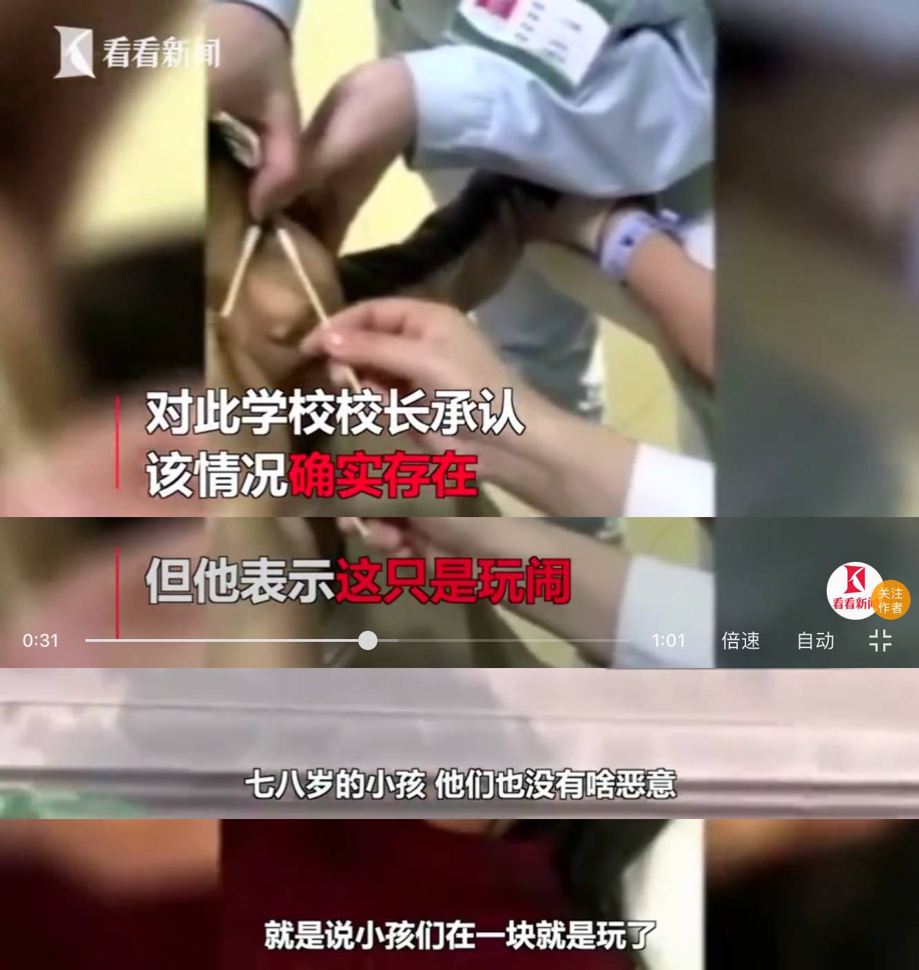 残忍 7岁小女孩眼睛被男生多次塞纸片