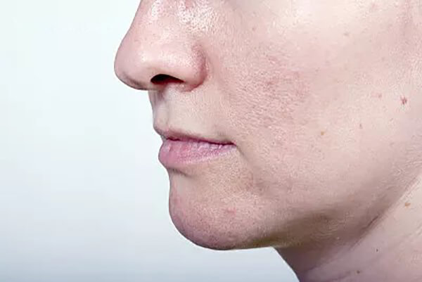 脸上爱出油怎么办认准这几个原因让自己一天天变漂亮