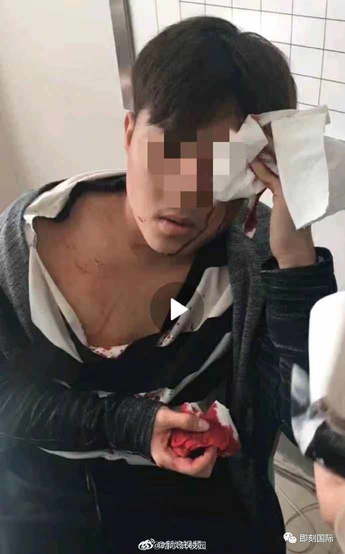 研究生因奖学金被同学捅伤校园何时如此暴力