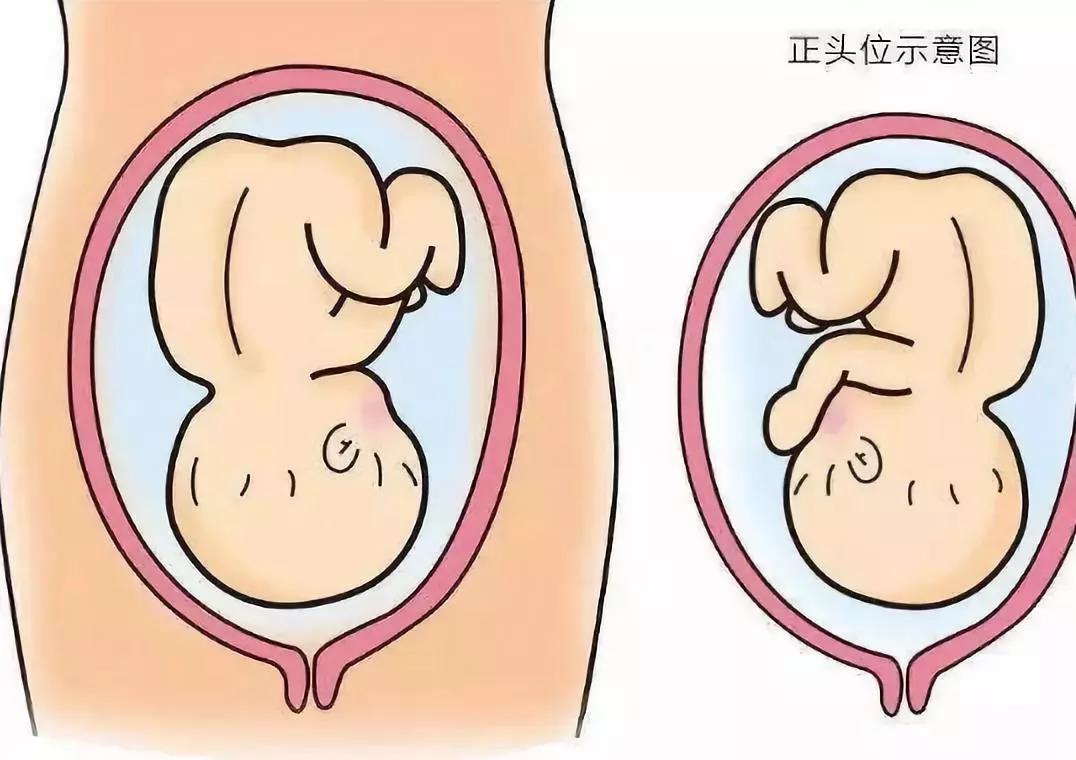 胎方位用十字图表示图片