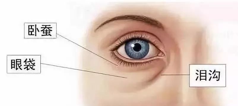 泪沟和卧蚕,看完下面这张图你就能明白这三者的形态和位置是不一样的
