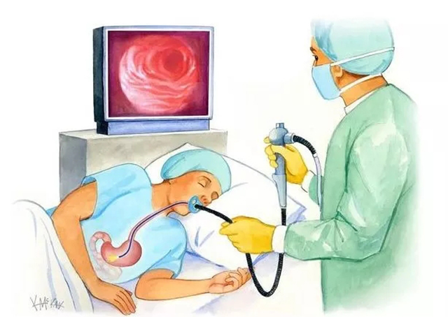 哪种胃炎最严重教你3分钟看懂胃镜报告单