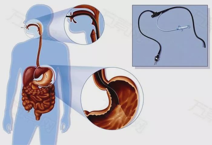 一篇文章,5分鐘閱讀,徹底弄清楚什麼是胃鏡__鳳凰網