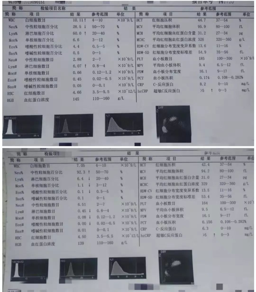 11x109/l,中性粒細胞百分比28.5%