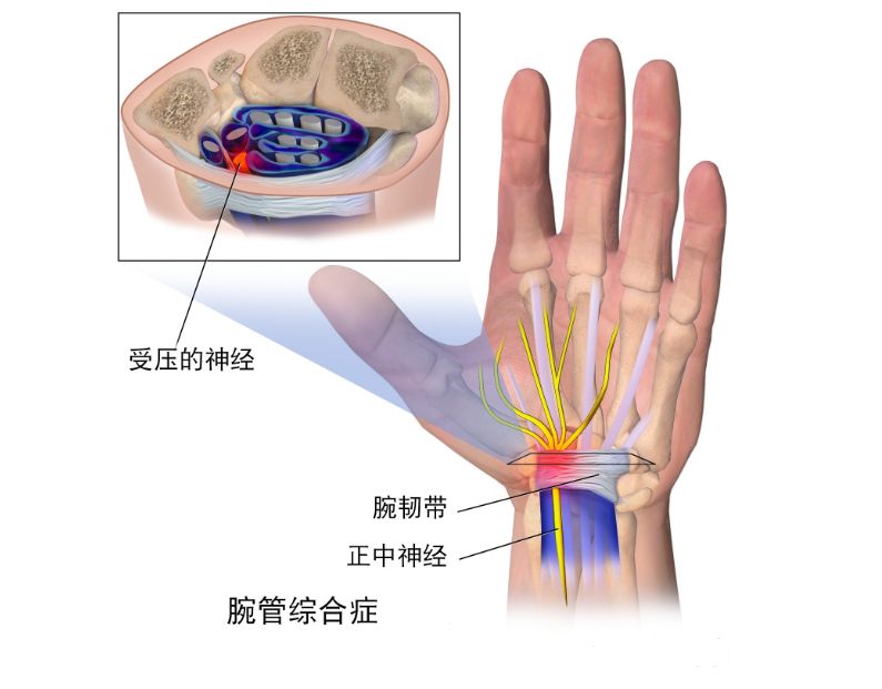 睡觉手麻要小心这3种原因经常被忽略