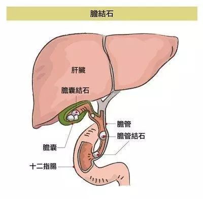 胆囊在哪里图片