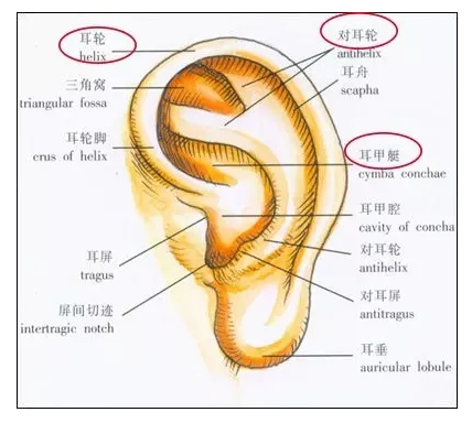 耳轮和耳舟粘连图片图片