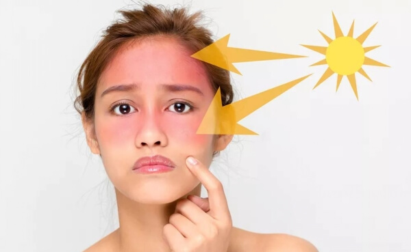 皮肤晒后如何修复missface护肤手把手教你怎么做晒后修复