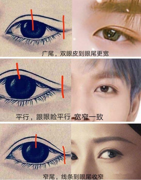 为什么割双眼皮后80%都后悔了!听我来分析 广尾,平行,窄尾. 广尾型