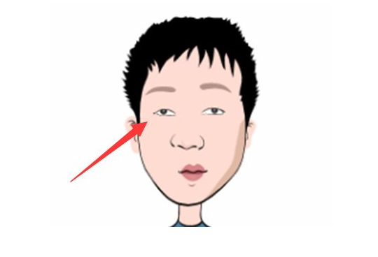 三白眼以及四白眼的男性在相学中被视为是拥有"狼性",性格狡黠且缺乏